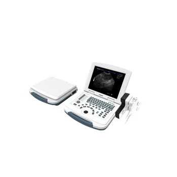 DW-580 mažą kainą nešiojamas ultragarsinis skeneris ir medicinos įranga