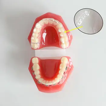 Dantų Mokymo Studijų Danties Modelis Aukštos Kokybės Ortodontinis Dantų Modeliai Nematomas Skaidrus Laikiklis Odontologija